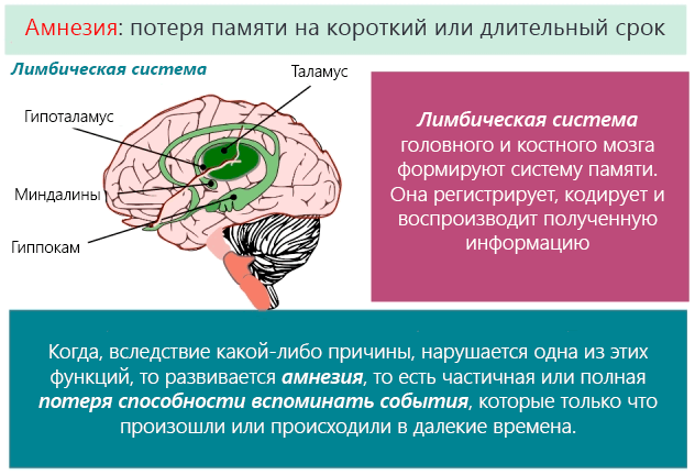 Почему нету головы