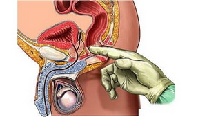 Aevita szedése prosztatagyulladásra Hogyan lehet megtudni, hogy a prosztatagyulladás gyógyul